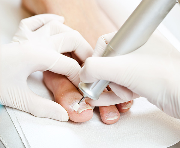 toe nail cutting service